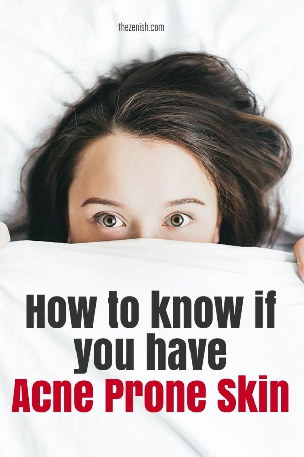 How To Know If You Have Acne Prone Skin 9 Skincare Tips From